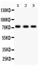 TP73 / p73 Antibody - p73 antibody Western blot. All lanes: Anti p73 at 0.5 ug/ml. Lane 1: HELA Whole Cell Lysate at 40 ug. Lane 2: MCF-7 Whole Cell Lysate at 40 ug. Lane 3: COLO320 Whole Cell Lysate at 40 ug. Predicted band size: 73 kD. Observed band size: 73 kD.