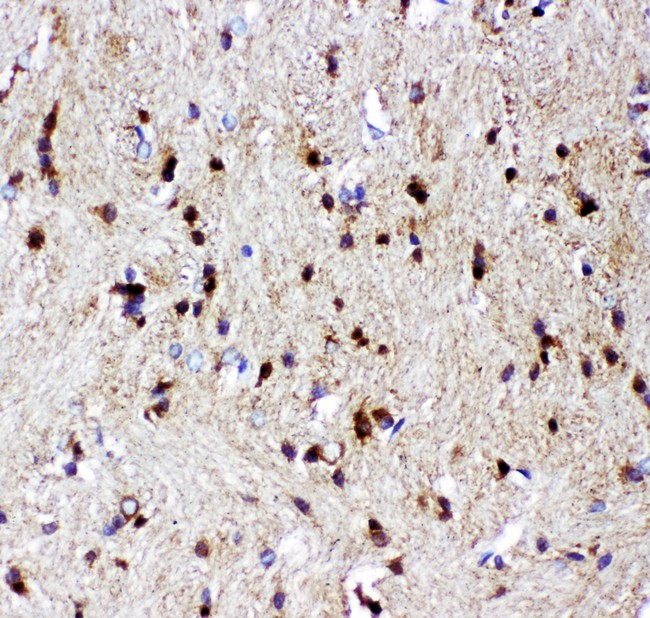 TP73 / p73 Antibody - p73 antibody IHC-paraffin: Rat Brain Tissue.