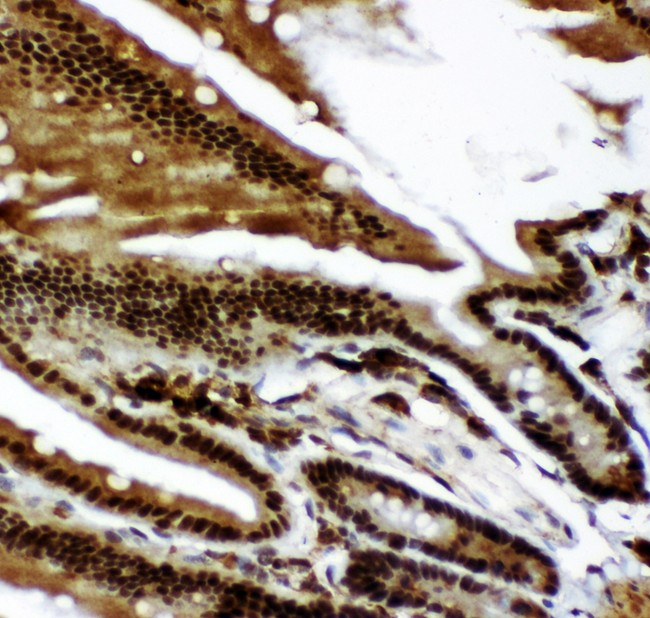 TP73 / p73 Antibody - p73 antibody IHC-paraffin: Mouse Intestine Tissue.