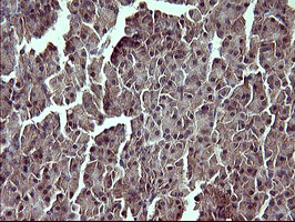 TP73 / p73 Antibody - IHC of paraffin-embedded Human pancreas tissue using anti-TP73 mouse monoclonal antibody. (Heat-induced epitope retrieval by 10mM citric buffer, pH6.0, 120°C for 3min).