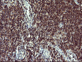 TP73 / p73 Antibody - IHC of paraffin-embedded Human lymph node tissue using anti-TP73 mouse monoclonal antibody. (Heat-induced epitope retrieval by 10mM citric buffer, pH6.0, 120°C for 3min).