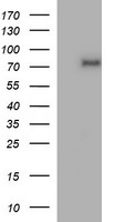 TP73 / p73 Antibody - HEK293T cells were transfected with the pCMV6-ENTRY control (Left lane) or pCMV6-ENTRY TP73 (Right lane) cDNA for 48 hrs and lysed. Equivalent amounts of cell lysates (5 ug per lane) were separated by SDS-PAGE and immunoblotted with anti-TP73.