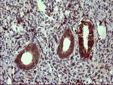 TP73 / p73 Antibody - IHC of paraffin-embedded Human endometrium tissue using anti-TP73 mouse monoclonal antibody. (Heat-induced epitope retrieval by 10mM citric buffer, pH6.0, 120°C for 3min).