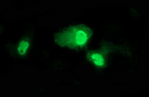 TP73 / p73 Antibody - Anti-TP73 mouse monoclonal antibody immunofluorescent staining of COS7 cells transiently transfected by pCMV6-ENTRY TP73.