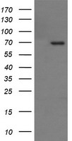 TP73 / p73 Antibody - HEK293T cells were transfected with the pCMV6-ENTRY control (Left lane) or pCMV6-ENTRY TP73 (Right lane) cDNA for 48 hrs and lysed. Equivalent amounts of cell lysates (5 ug per lane) were separated by SDS-PAGE and immunoblotted with anti-TP73.