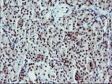 TP73 / p73 Antibody - IHC of paraffin-embedded Human pancreas tissue using anti-TP73 mouse monoclonal antibody.