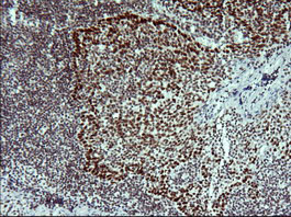 TP73 / p73 Antibody - IHC of paraffin-embedded Human lymph node tissue using anti-TP73 mouse monoclonal antibody.