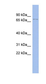 TP73 / p73 Antibody - TP73 / p73 antibody Western blot of ACHN lysate. This image was taken for the unconjugated form of this product. Other forms have not been tested.