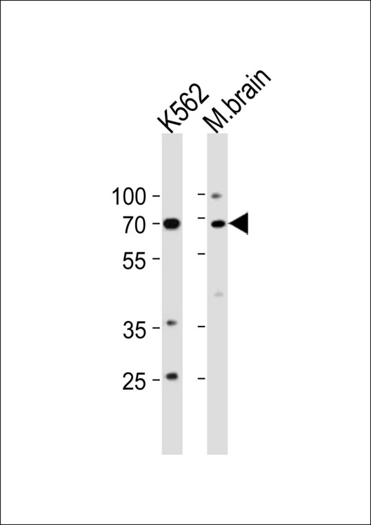 TP73 / p73 Antibody - TP73 Antibody western blot of K562 cell line and mouse brain tissue lysates (35 ug/lane). The TP73 antibody detected the TP73 protein (arrow).