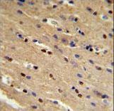 TP73 / p73 Antibody - TP73 Antibody IHC of formalin-fixed and paraffin-embedded mouse brain followed by peroxidase-conjugated secondary antibody and DAB staining.