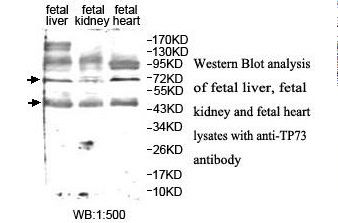 TP73 / p73 Antibody