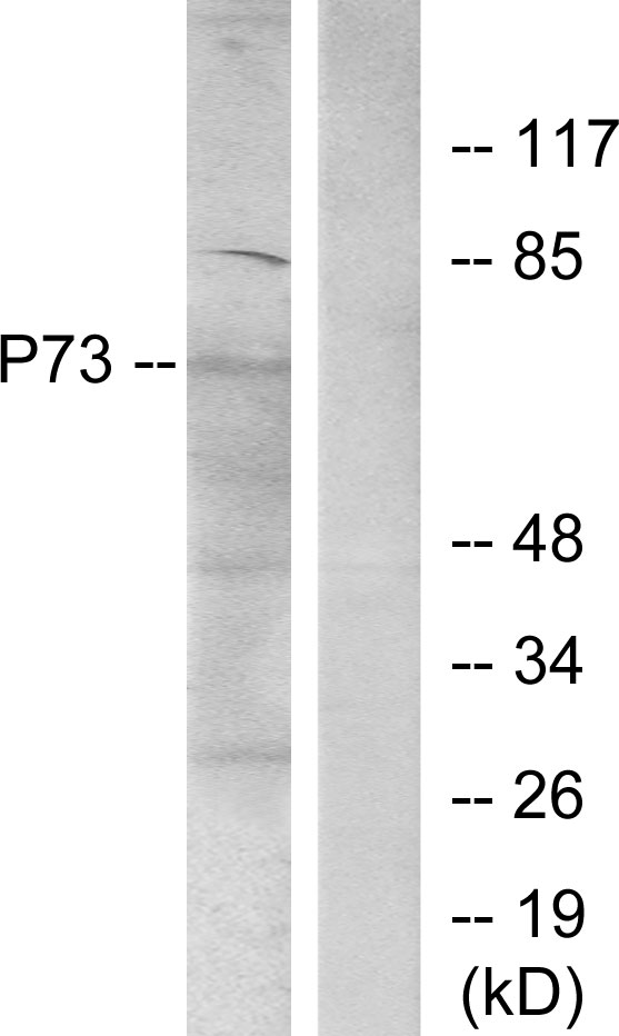 TP73 / p73 Antibody - Western blot analysis of lysates from K562 cells, using p73 Antibody. The lane on the right is blocked with the synthesized peptide.