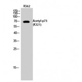 TP73 / p73 Antibody - Western blot of Acetyl-p73 (K321) antibody