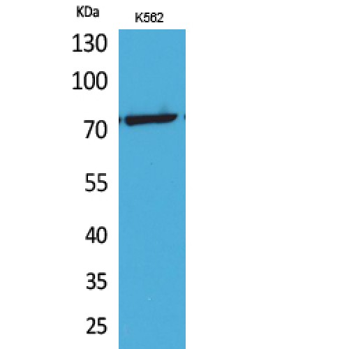 TP73 / p73 Antibody - Western blot of Acetyl-p73 (K321) antibody
