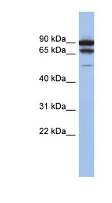 TP73 / p73 Antibody - TP73 / p73 antibody Western blot of THP-1 cell lysate. This image was taken for the unconjugated form of this product. Other forms have not been tested.