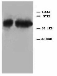 TP73 / p73 Antibody -  This image was taken for the unconjugated form of this product. Other forms have not been tested.
