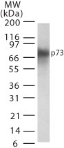 TP73 / p73 Antibody - Western blot of p73 in transfected cell lysate using antibody at 1:500.