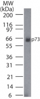 TP73 / p73 Antibody - Western blot of p73 in HeLa cell lysate using antibody at 1:500.