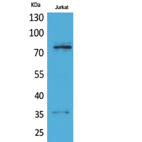TP73 / p73 Antibody - Western blot of p73 antibody