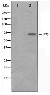 TP73 / p73 Antibody - Western blot of Jurkat cell lysate using p73 Antibody