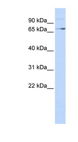 TP73 / p73 Antibody - TP73 / p73 antibody Western blot of 293T cell lysate. This image was taken for the unconjugated form of this product. Other forms have not been tested.