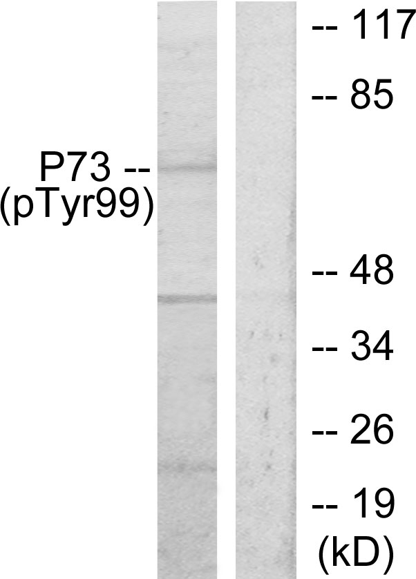 TP73 / p73 Antibody - Western blot analysis of lysates from K562 cells treated with Pervanadate, using p73 (Phospho-Tyr99) Antibody. The lane on the right is blocked with the phospho peptide.