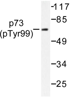 TP73 / p73 Antibody - Western blot of p-p73 (Y99) pAb in extracts from HeLa cells.