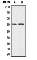 TP73 / p73 Antibody - Western blot analysis of p73 (pY99) expression in Jurkat (A); HeLa UV-treated (B) whole cell lysates.