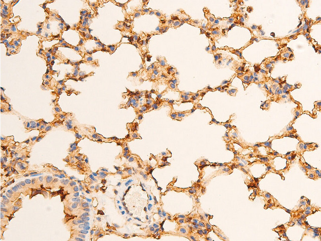 TP73 / p73 Antibody - 1:100 staining mouse lung tissue by IHC-P. The tissue was formaldehyde fixed and a heat mediated antigen retrieval step in citrate buffer was performed. The tissue was then blocked and incubated with the antibody for 1.5 hours at 22°C. An HRP conjugated goat anti-rabbit antibody was used as the secondary.
