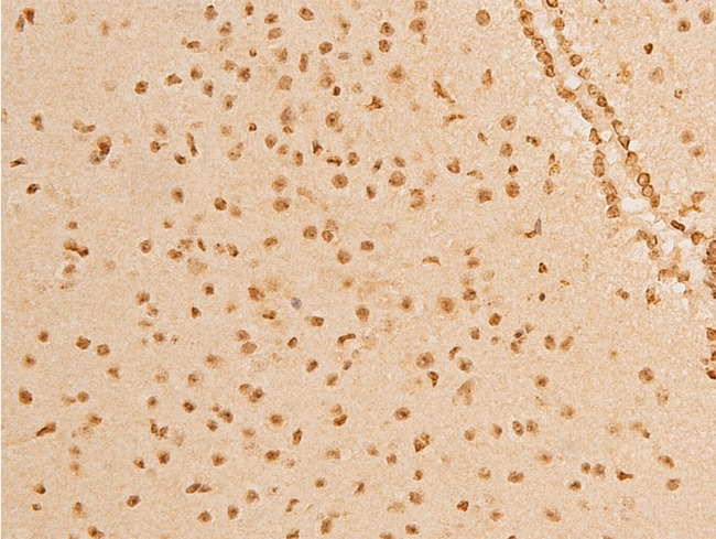 TP73 / p73 Antibody - 1:100 staining mouse brain tissue by IHC-P. The tissue was formaldehyde fixed and a heat mediated antigen retrieval step in citrate buffer was performed. The tissue was then blocked and incubated with the antibody for 1.5 hours at 22°C. An HRP conjugated goat anti-rabbit antibody was used as the secondary.