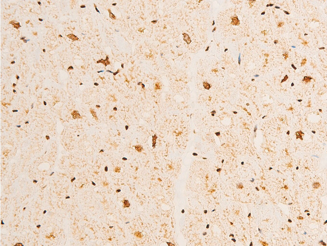 TP73 / p73 Antibody - 1:100 staining human heart tissue by IHC-P. The tissue was formaldehyde fixed and a heat mediated antigen retrieval step in citrate buffer was performed. The tissue was then blocked and incubated with the antibody for 1.5 hours at 22°C. An HRP conjugated goat anti-rabbit antibody was used as the secondary.
