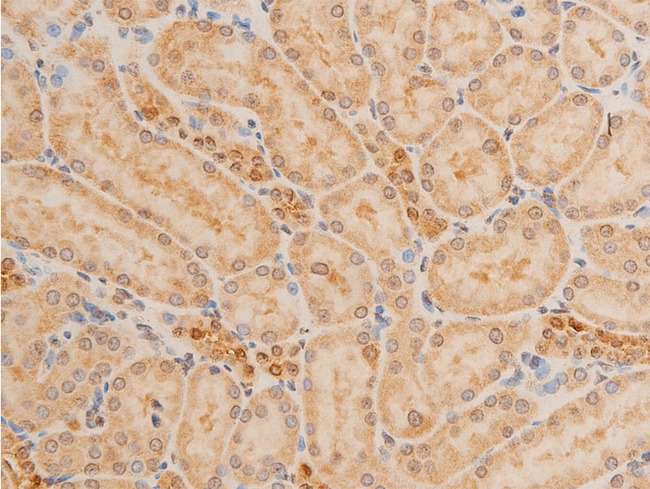 TP73 / p73 Antibody - 1:100 staining rat kidney tissue by IHC-P. The tissue was formaldehyde fixed and a heat mediated antigen retrieval step in citrate buffer was performed. The tissue was then blocked and incubated with the antibody for 1.5 hours at 22°C. An HRP conjugated goat anti-rabbit antibody was used as the secondary.