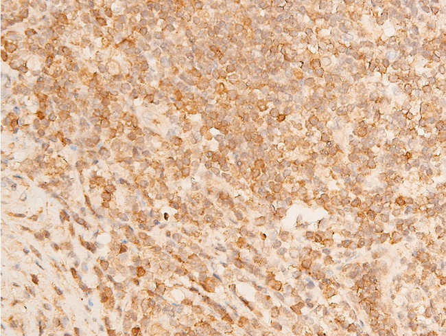 TP73 / p73 Antibody - 1:100 staining human appendix tissue by IHC-P. The tissue was formaldehyde fixed and a heat mediated antigen retrieval step in citrate buffer was performed. The tissue was then blocked and incubated with the antibody for 1.5 hours at 22°C. An HRP conjugated goat anti-rabbit antibody was used as the secondary.