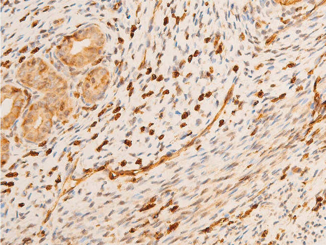 TP73 / p73 Antibody - 1:100 staining rat uterine tissue by IHC-P. The tissue was formaldehyde fixed and a heat mediated antigen retrieval step in citrate buffer was performed. The tissue was then blocked and incubated with the antibody for 1.5 hours at 22°C. An HRP conjugated goat anti-rabbit antibody was used as the secondary.