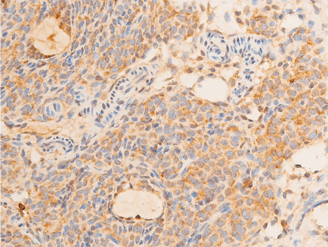 TP73 / p73 Antibody - 1:100 staining rat ovarian tissue by IHC-P. The tissue was formaldehyde fixed and a heat mediated antigen retrieval step in citrate buffer was performed. The tissue was then blocked and incubated with the antibody for 1.5 hours at 22°C. An HRP conjugated goat anti-rabbit antibody was used as the secondary.