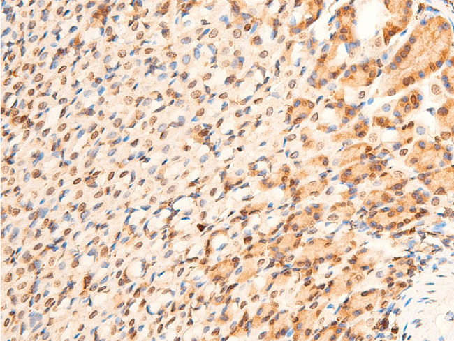 TP73 / p73 Antibody - 1:100 staining mouse gastric tissue by IHC-P. The tissue was formaldehyde fixed and a heat mediated antigen retrieval step in citrate buffer was performed. The tissue was then blocked and incubated with the antibody for 1.5 hours at 22°C. An HRP conjugated goat anti-rabbit antibody was used as the secondary.