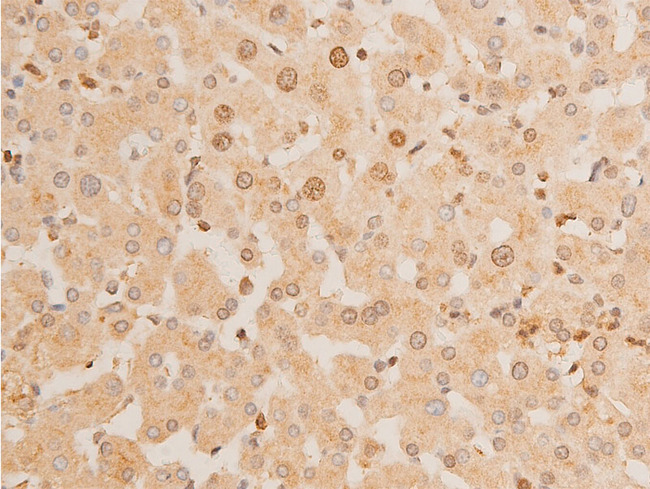 TP73 / p73 Antibody - 1:100 staining human liver tissue by IHC-P. The tissue was formaldehyde fixed and a heat mediated antigen retrieval step in citrate buffer was performed. The tissue was then blocked and incubated with the antibody for 1.5 hours at 22°C. An HRP conjugated goat anti-rabbit antibody was used as the secondary.