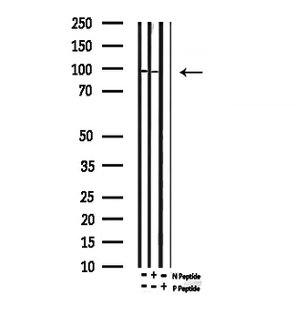 TP73 / p73 Antibody - Western blot analysis of Phospho-p73 (Tyr99) expression in mouse lung lysate
