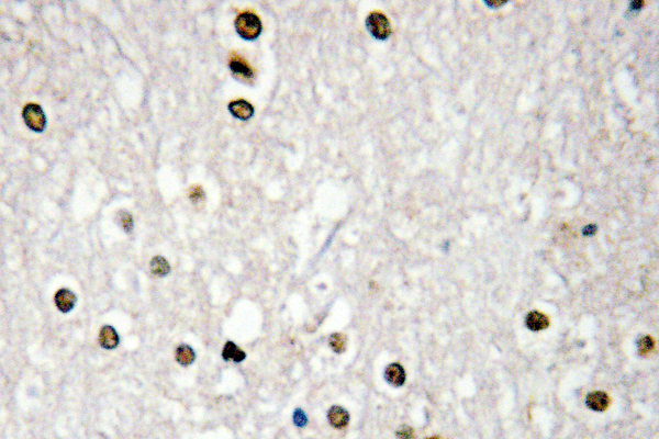 TP73 / p73 Antibody - IHC of p73 (P298) pAb in paraffin-embedded human brain tissue.