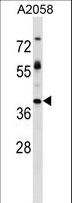 TPBG / 5T4 Antibody - TPBG Antibody western blot of A2058 cell line lysates (35 ug/lane). The TPBG antibody detected the TPBG protein (arrow).