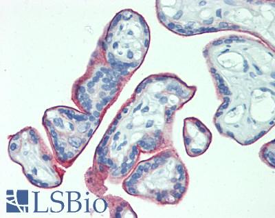 TPBG / 5T4 Antibody - Human Placenta: Formalin-Fixed, Paraffin-Embedded (FFPE)