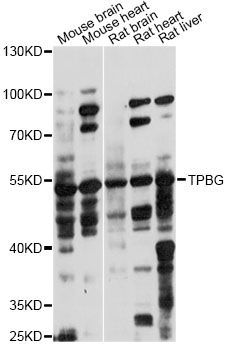 TPBG / 5T4 Antibody - Western blot analysis of extracts of various cell lines, using TPBG antibody at 1:1000 dilution. The secondary antibody used was an HRP Goat Anti-Rabbit IgG (H+L) at 1:10000 dilution. Lysates were loaded 25ug per lane and 3% nonfat dry milk in TBST was used for blocking. An ECL Kit was used for detection and the exposure time was 60s.