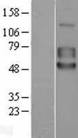 TPBG / 5T4 Protein - Western validation with an anti-DDK antibody * L: Control HEK293 lysate R: Over-expression lysate
