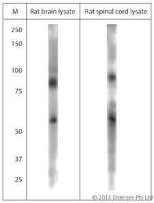 TPC1 / TPCN1 Antibody - Rabbit antibody to TPC1 (750-800). WB on rat brain and spinal cord lysate using Rabbit antibody to TPC1 (750-800), Dilution: 1:500, incubated overnight at 4C in MPX from LiCor. Blocking buffer: 0.2 micron filtered 0.5% LFDM in 1x PBS containing 0.01% Tween-20. Washing buffer: 1x PBS. Detection: ECL using C-Digit from LiCor.