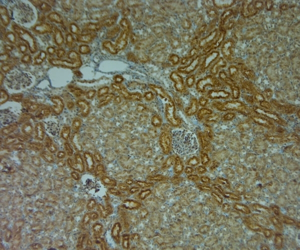 TPC1 / TPCN1 Antibody - Rabbit antibody to TPC1 (750-800). IHC-P on paraffin sections of rat kidney using Rabbit antibody to TPC1 (750-800) HIER: 1 mM EDTA, pH 8 for 20 min using Thermo PT Module. Blocking: 0.2% LFDM in TBST filtered through a 0.2 micron filter. Detection was done using Novolink HRP polymer from Leica following manufacturers instructions. Primary antibody: dilution 1:1000, incubated 30 min at RT (using Autostainer).