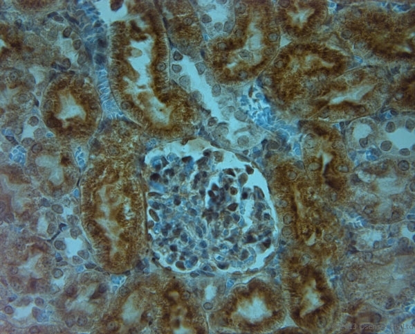 TPC1 / TPCN1 Antibody - Rabbit antibody to TPC1 (750-800). IHC-P on paraffin sections of rat kidney using Rabbit antibody to TPC1 (750-800) HIER: 1 mM EDTA, pH 8 for 20 min using Thermo PT Module. Blocking: 0.2% LFDM in TBST filtered through a 0.2 micron filter. Detection was done using Novolink HRP polymer from Leica following manufacturers instructions. Primary antibody: dilution 1:1000, incubated 30 min at RT (using Autostainer).
