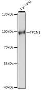 TPC1 / TPCN1 Antibody - Western blot analysis of extracts of rat lung using TPCN1 Polyclonal Antibody at dilution of 1:1000.