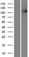 TPC1 / TPCN1 Protein - Western validation with an anti-DDK antibody * L: Control HEK293 lysate R: Over-expression lysate