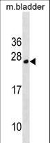 TPD52L1 Antibody - TPD52L1 Antibody western blot of mouse bladder tissue lysates (35 ug/lane). The TPD52L1 antibody detected the TPD52L1 protein (arrow).