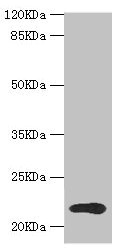 TPD52L1 Antibody - Western blot All Lanes:TPD52L1 antibody at 1.31ug/ml+MCF-7 whole cell lysate Secondary Goat polyclonal to rabbit at 1/10000 dilution Predicted band size: 23,17,15,12,20 kDa Observed band size: 22 kDa
